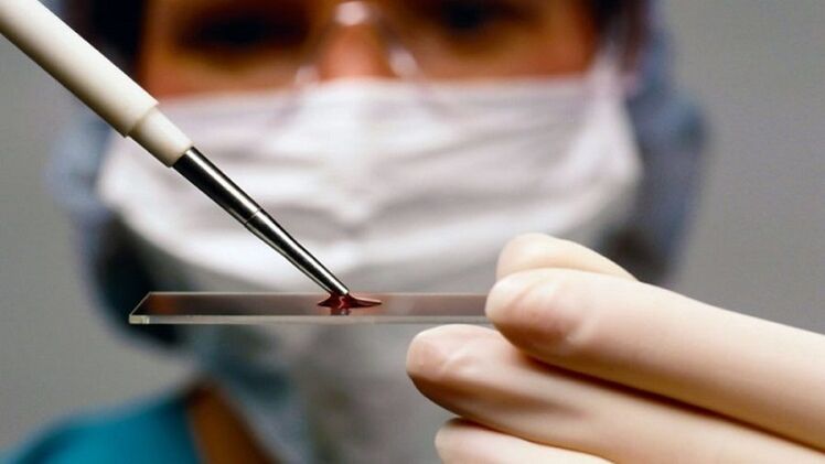 Diagnose des humanen Papillomavirus